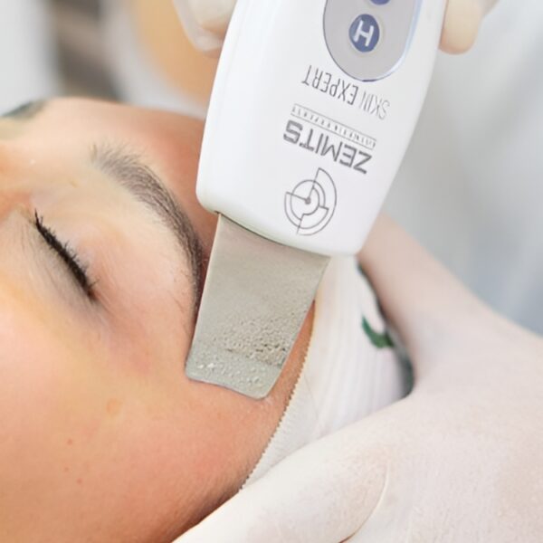 Peeling Ultrassônico